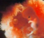 10.Semana  El feto  60 000 veces más grande que el óvulo fecundado con el cual comenzó todo. Comienza a chupar el pulgar y puede dar saltos mortales en su hábitad. (Tamaño: 6 cms)
