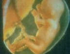 12. Week

Todos los �rganos trabajan. El foetus,conception,life,prolife,murder,abortion, respira, traga, digiere y orina. Ya puede aprender y experimenta el ru�do. Duerme cuando duerme su madre. En su cabeza aprecen los primeros pelos. Est� aprendiendo cont�nuamente.
(Tama�o: 9 cms)