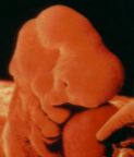 3. Semana  El embrión posee un corazón en forma de 