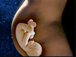 feto derecho a vivir