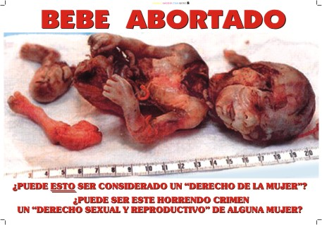 Católicas por el Derecho a Decidir, NO ES UNA ORGANIZACIÓN CATÓLICA - promueven el aborto asesinato de los indefensos 