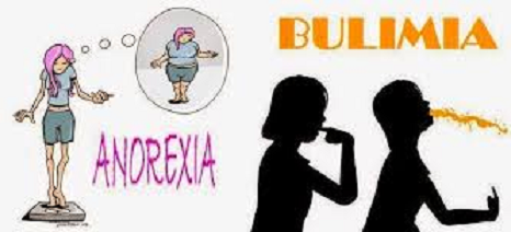 Bulimia Anorexia